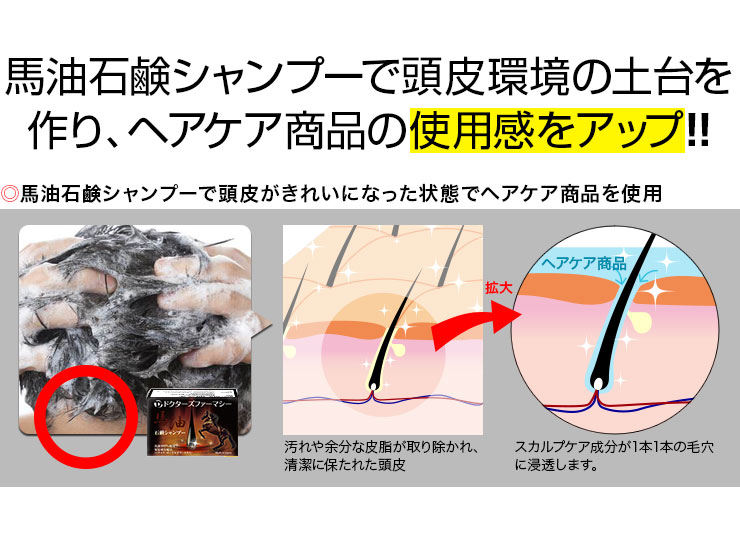 馬油石鹸シャンプーで頭皮環境改善後、育毛剤使用で効果期待大!!