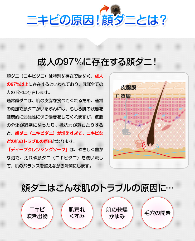 オパシー ニキビ用石鹸